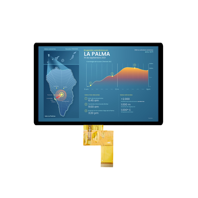 Özel TFT Modülü Yüksek Parlaklık IPS/VA TFT LCD Panel Tıbbi Cihazlar için CTP/RTP ile
